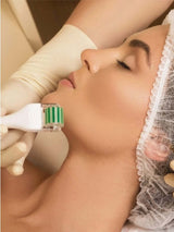 Mikroneedling Hyaluronsäure Behandlung